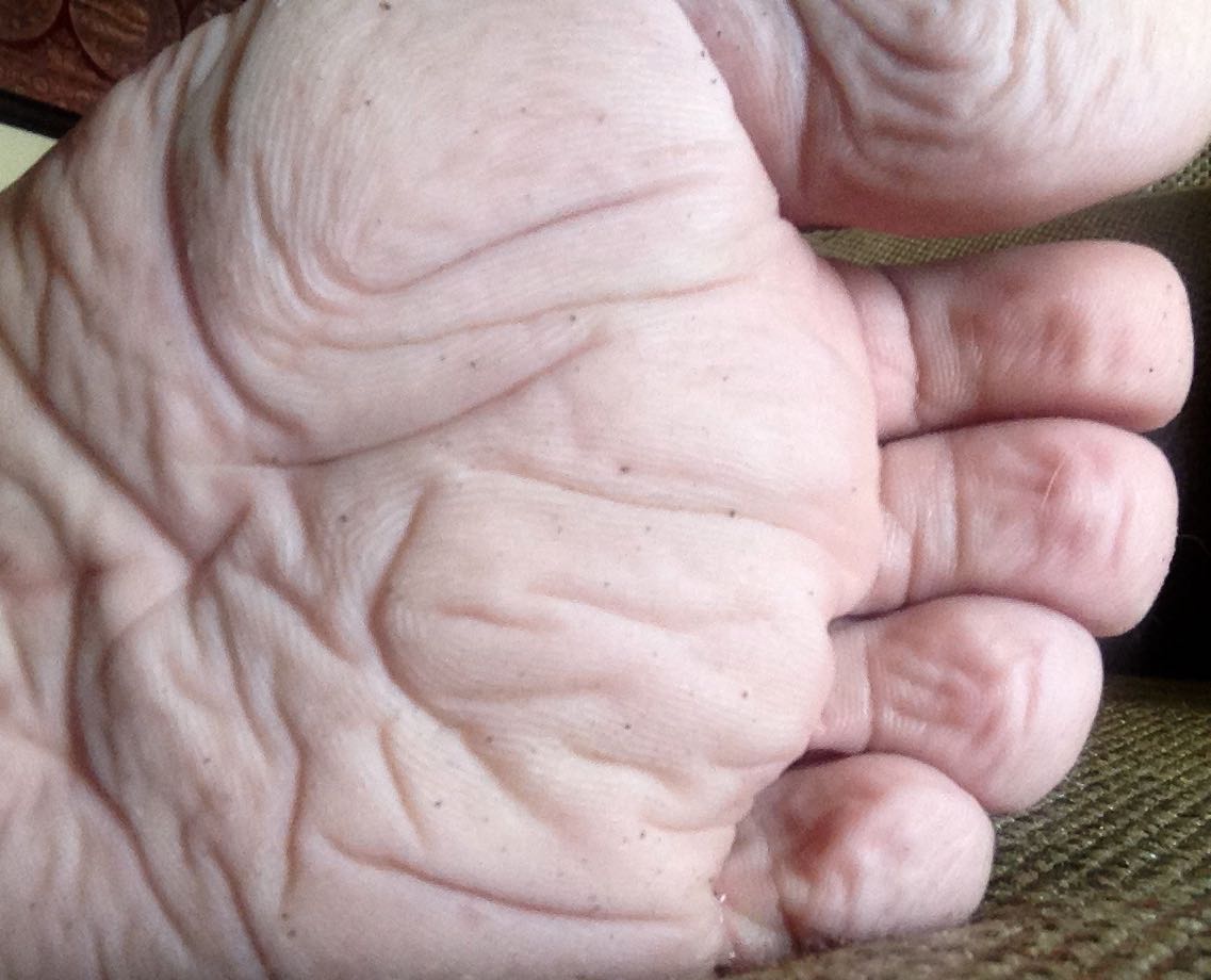 Lack of breathability may cause your feet to look like raw turnips. Even worse, macerated feet are blister prone.