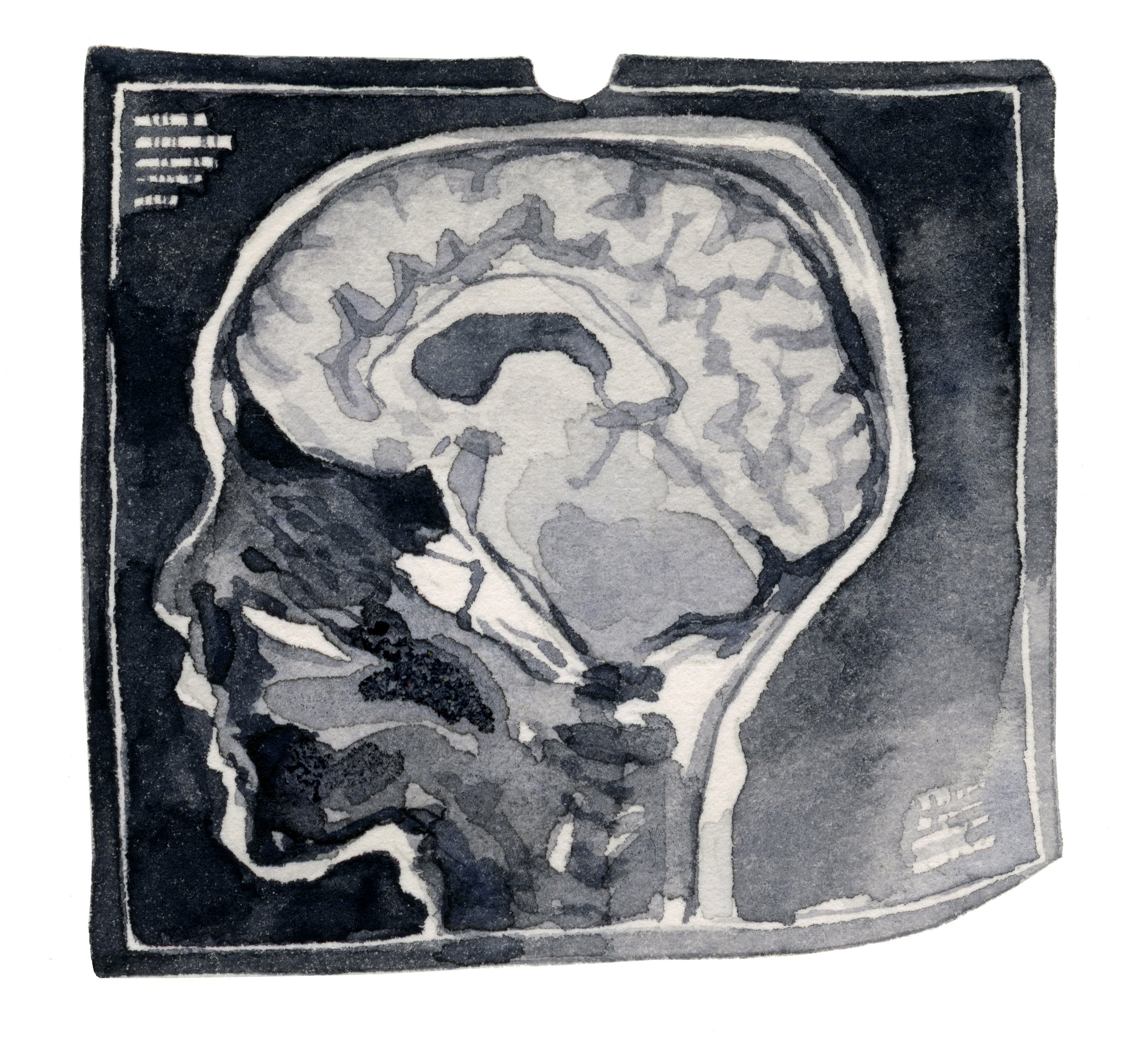 6 MRI-web.jpg