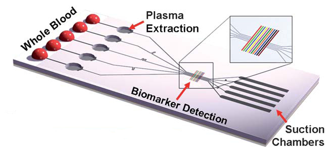 The degassed chip draws in blood towards the dead-end suction chambers. The wells filter the blood before passing the detection strips.