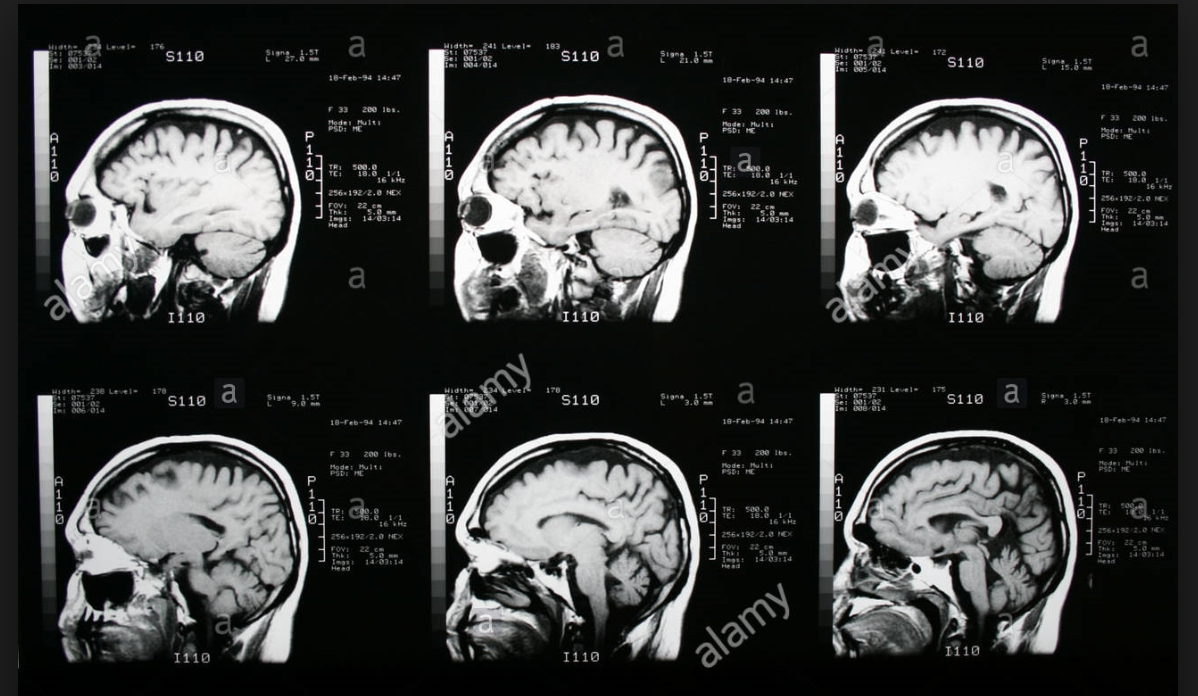 MRI image.