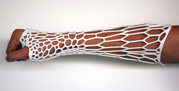 Cortex is a 3D printed exoskeletal cast concept designed to replace traditional plaster casts. Read more
