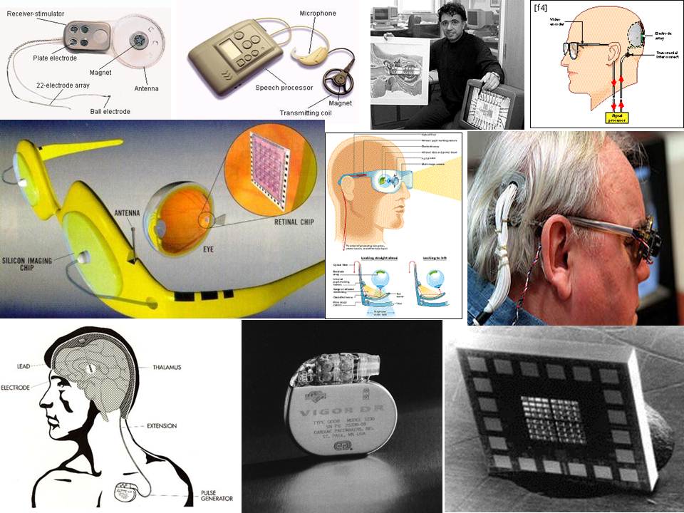 Exhibit 8.10 Various Medical Implant Applications