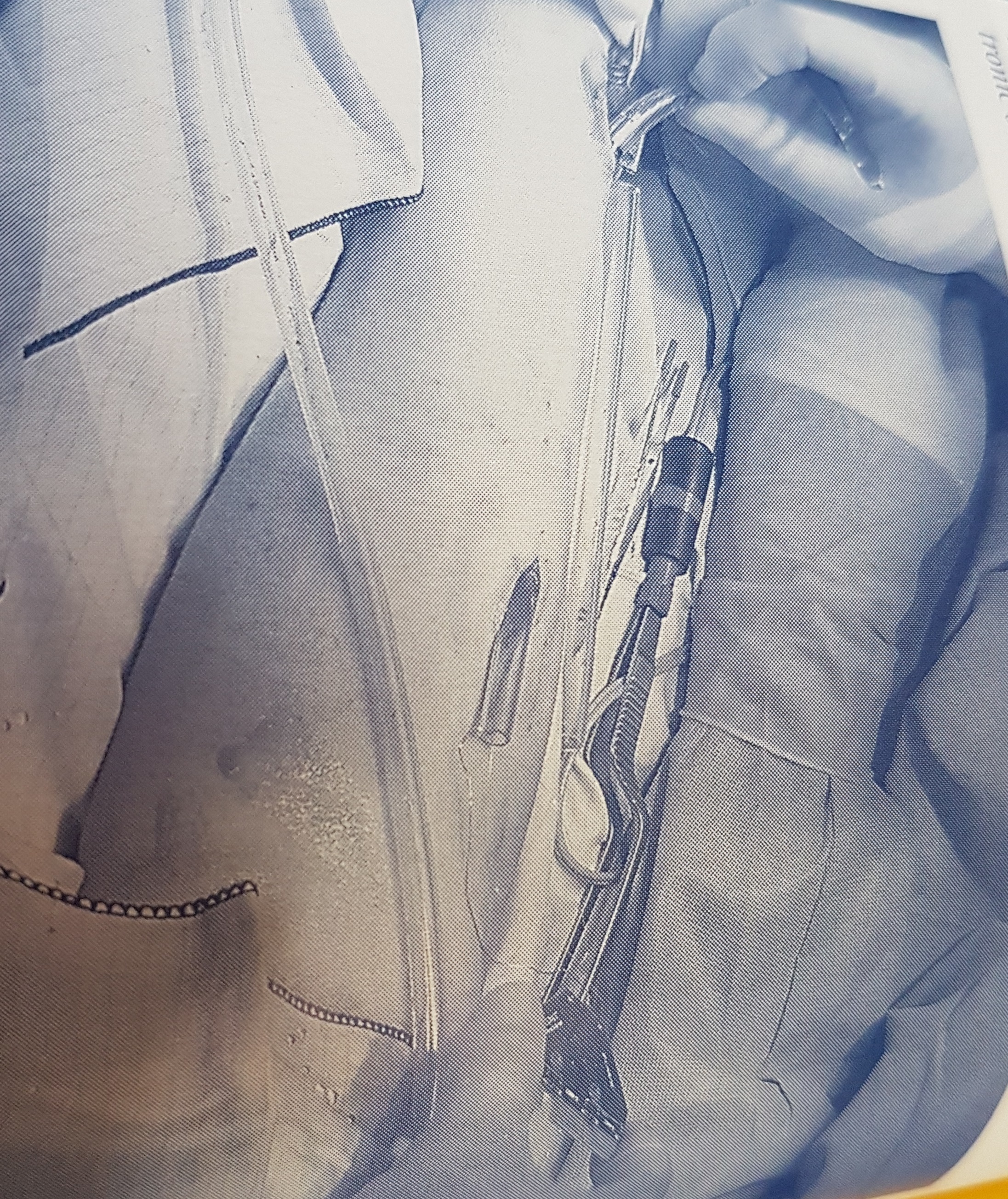 FIGURE C5.2: Professor Warwick havinq a chip implanted into his left arm (news.bbc.co.uk/hl/english/sci/tech/newsid_158000/158007.stm)