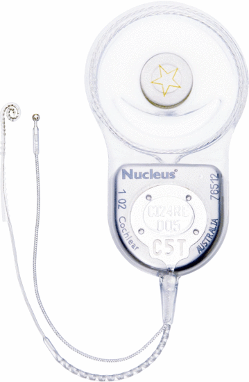 Fig. 16. Cochlear's Nucleus Freedom implant with Contour Advance electrode which is impervious to magnetic fields up to 1.5 Tesla. Courtesy of Cochlear Australia.