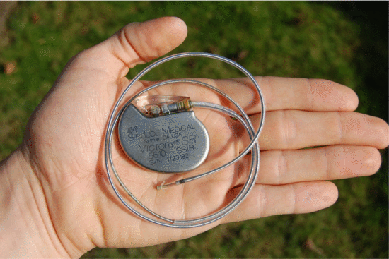 Fig. 18. An artificial pacemaker from St. Jude Medical (St. Paul, MN), with electrode 2007. Courtesy of Steven Fruitsmaak.