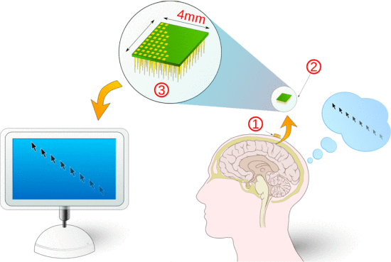 Fig. 23. Brain–computer interface schema. (1) Pedestal. (2) Sensor. (3) Electrode. Courtesy of Balougador under creative commons license.