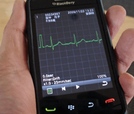 Figure 5. The medical waveform format encoding rule software on a Blackberry device. It displays medical waveforms, such as EKG (shown), electroencephalogram, and blood pressure. Some doctors have software that allows them to interrogate EKG information, but patients presently do not have access to their own ICD data. (Photo courtesy of wikimedia commons.)