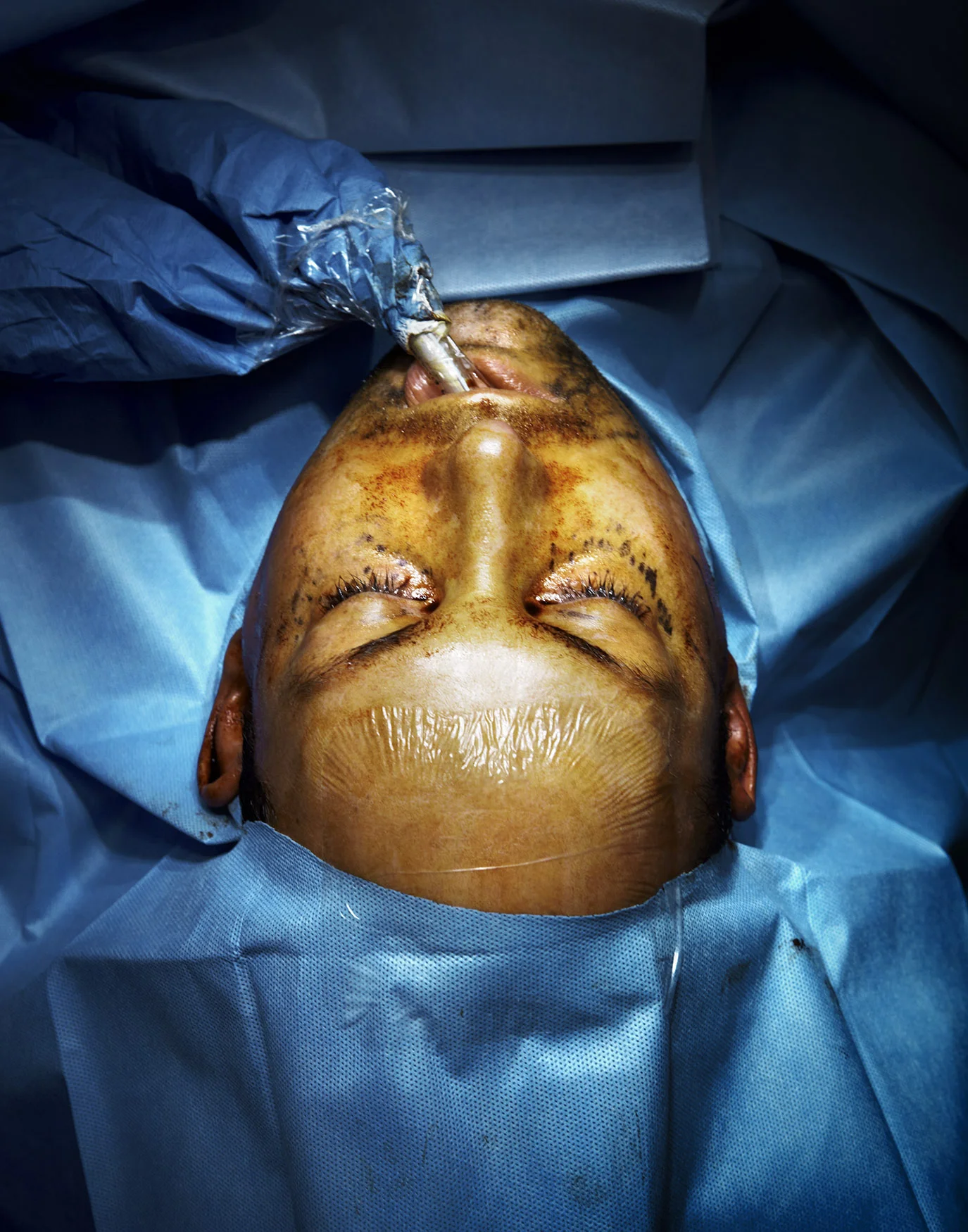 111215_Aesthete_Surgery_L01_0588.jpg