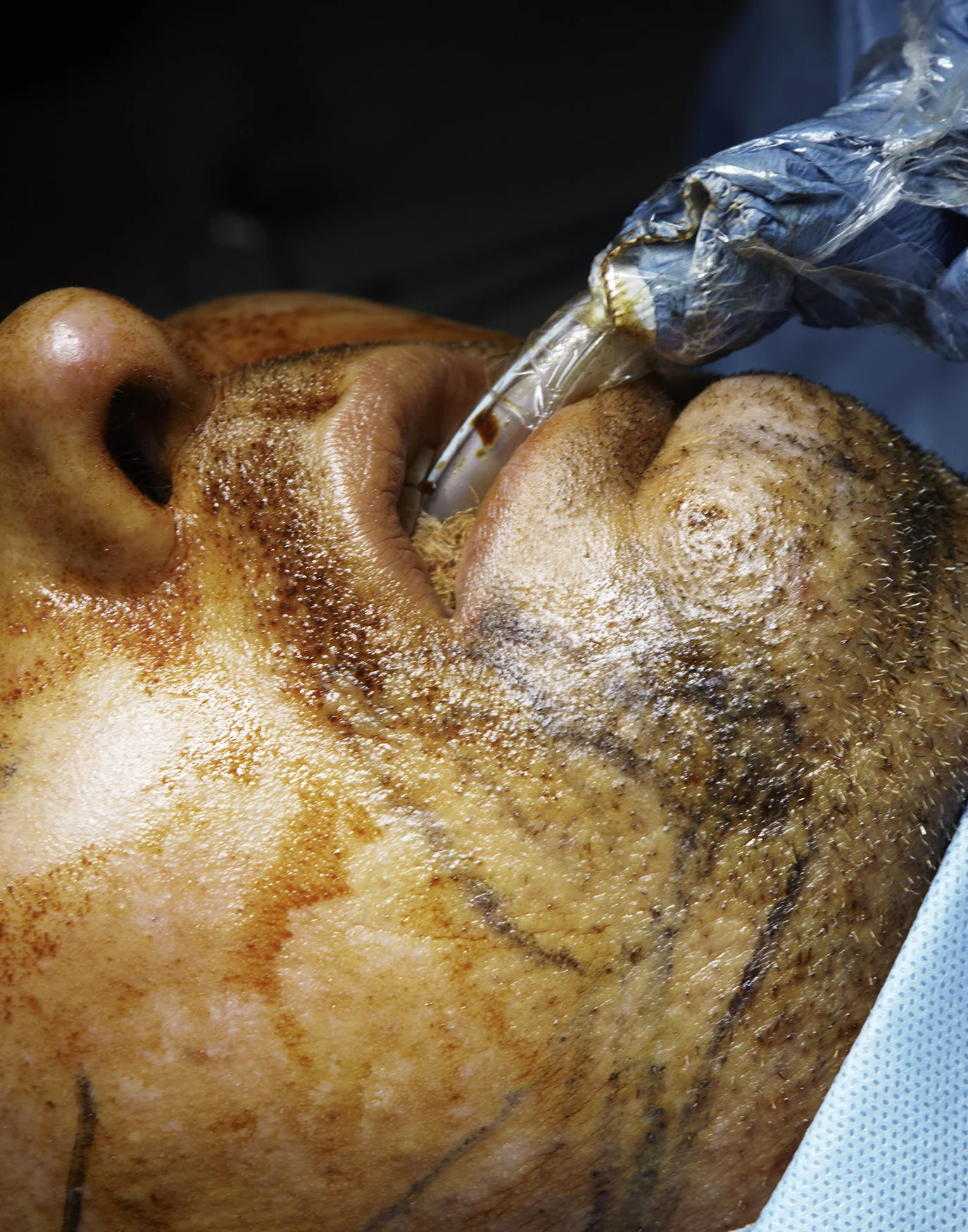 111215_Aesthete_Surgery_L01_0572.jpg