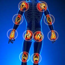 arthrite.jpg