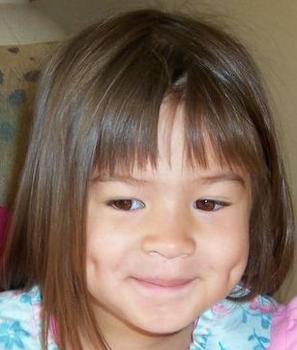 dimples