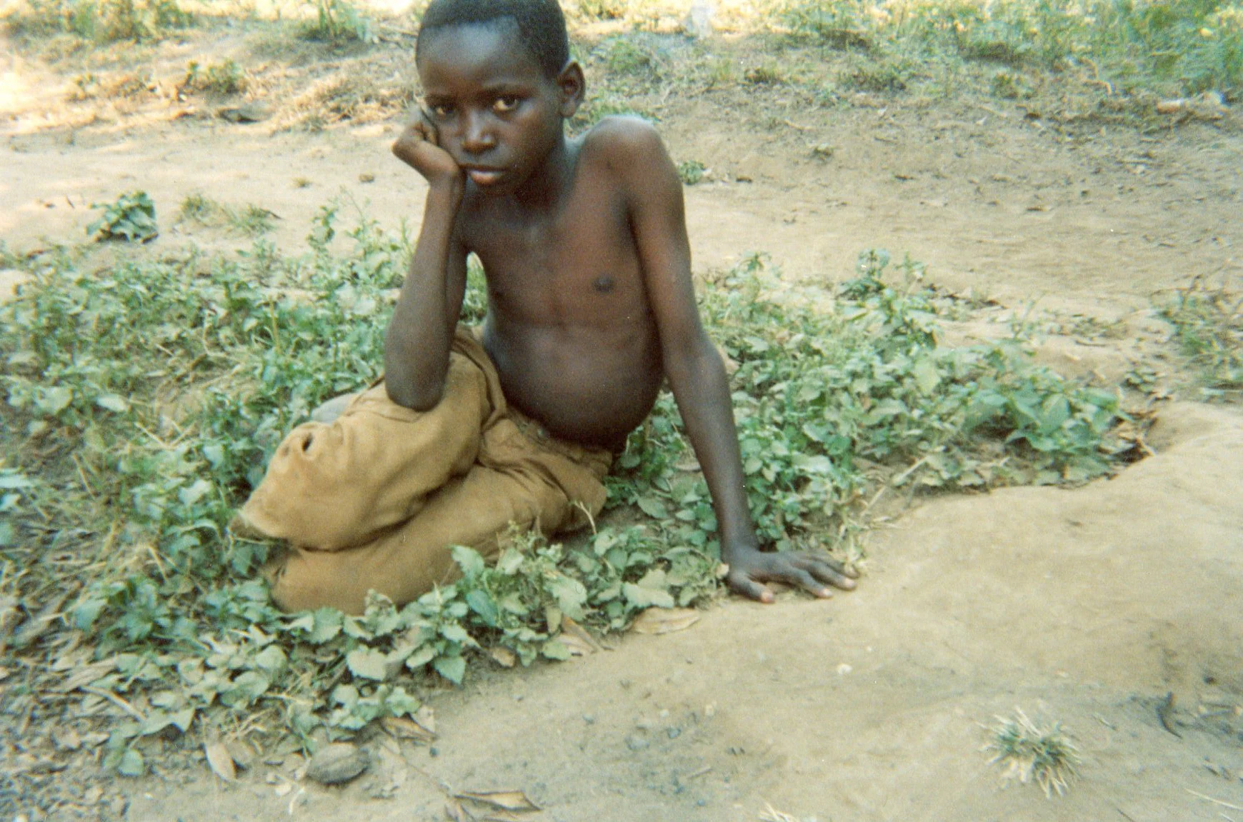 This child who is an orphan has no support or protection in their community. 