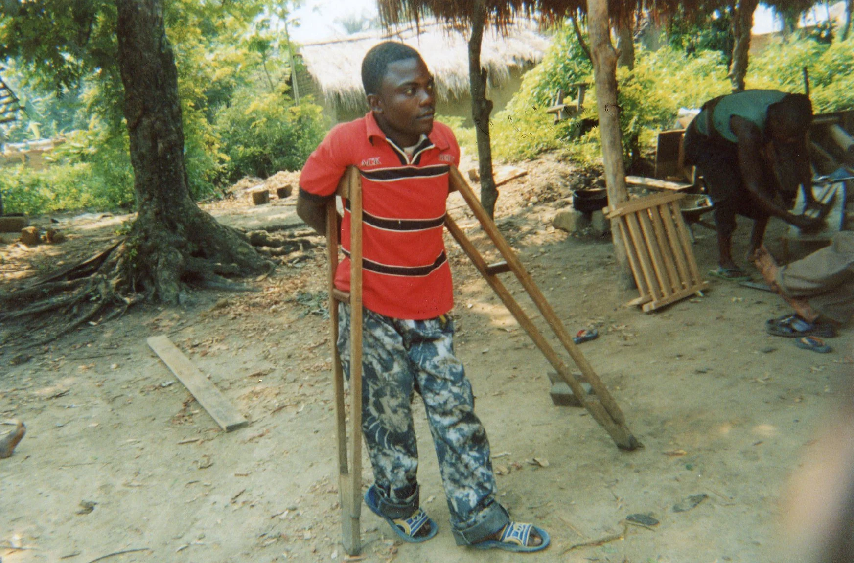The boy's leg was broken by bullets during the war. 
