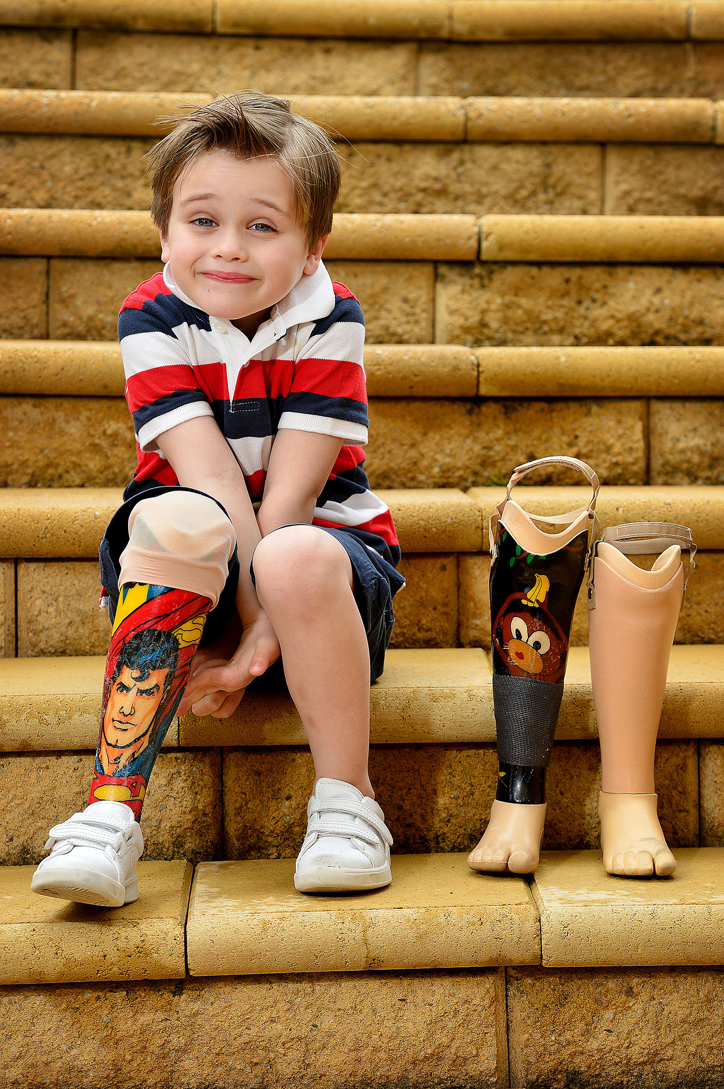  29.8.16 - William White (5) proudly shows off his prosthetic legs at his family's Craigburn Farm home. When William was 2, he was hit by a falling branch in a public park, during February 2014's heat wave. He spent time in ICU and had one of his leg