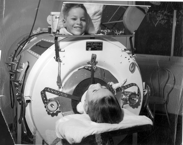 Living it up in an iron lung.