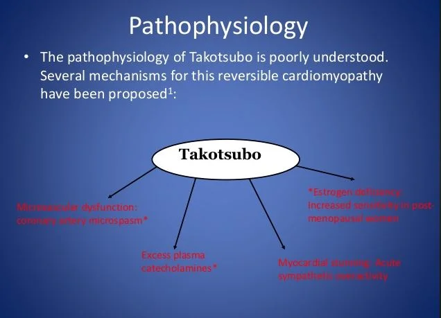 Takotsubo pathophysiology.JPG