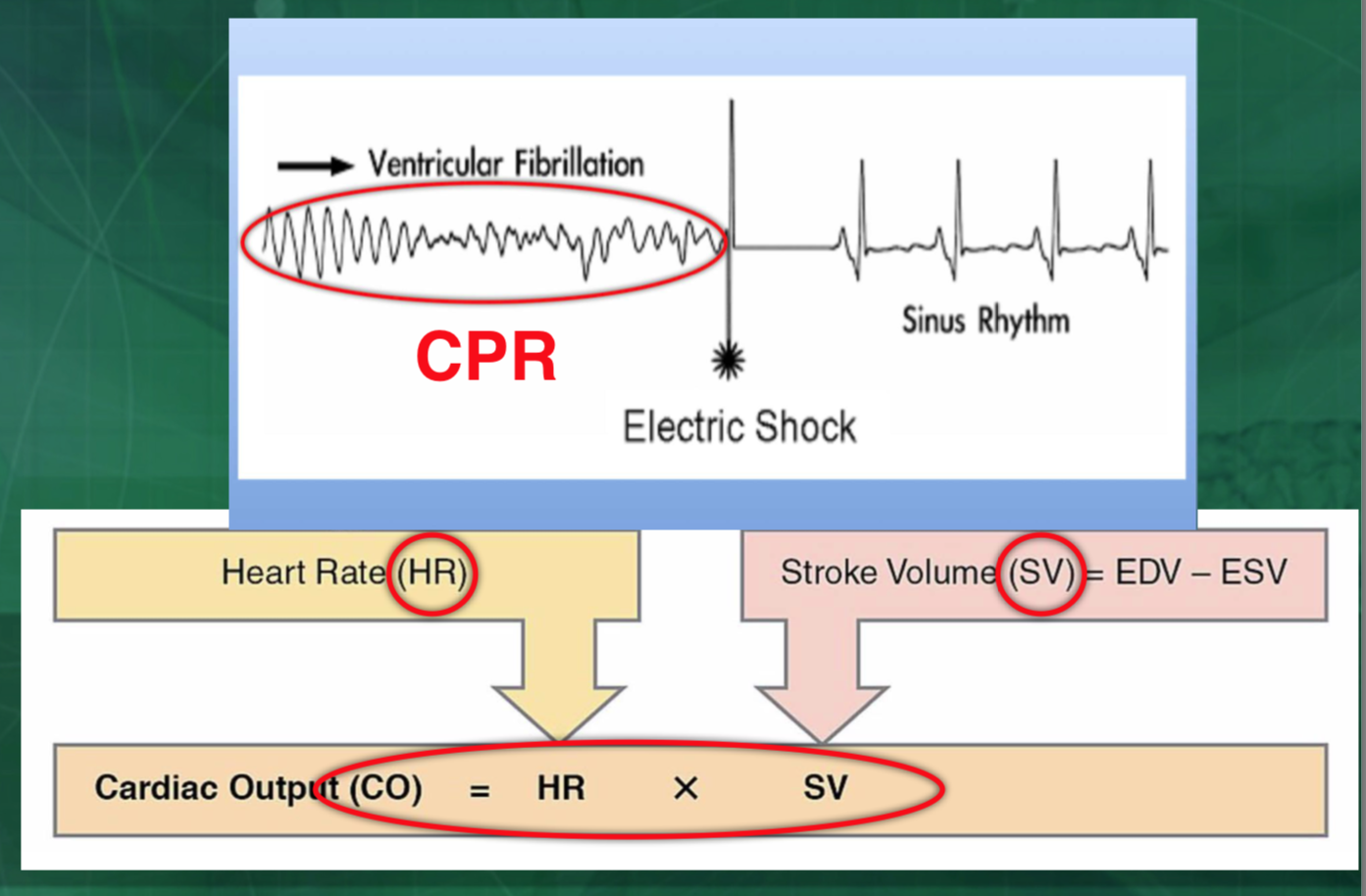 …………………………………………… CO ( during CPR) = HR (compression rate) X SV (depth of compression) ……………………………………………