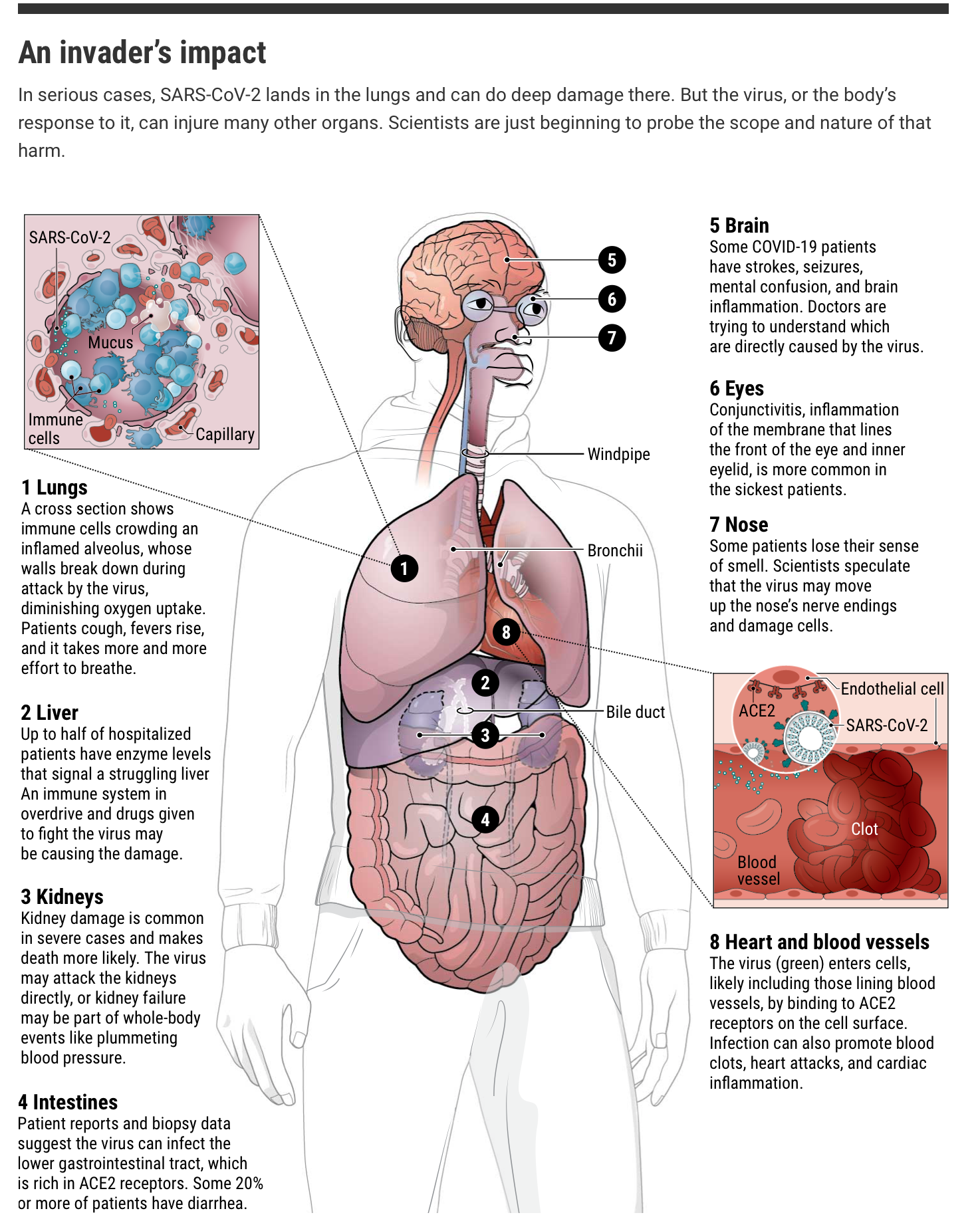 How does coronavirus kill? - Science AAAS - 4/17/20