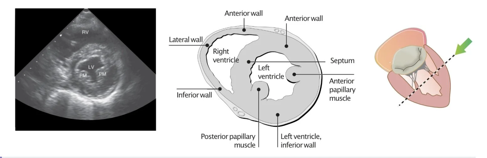 source: ecgwaves.com - excellent detailed and illustrated explanations of ECG interpretation and echocardiography