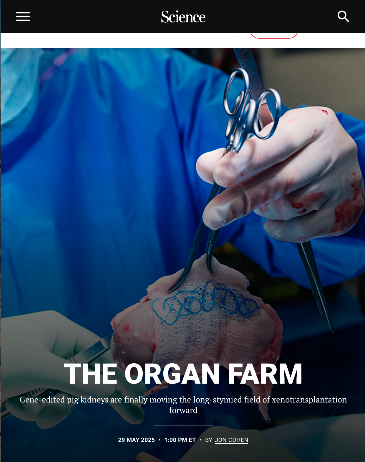link to article Attempts to provide humans with animal organs—known as xenotransplantation—date back more than a century, a history marked by hype and dashed hopes. As surgeon Norman Shumway, who helped pioneer human-to-human heart transplant