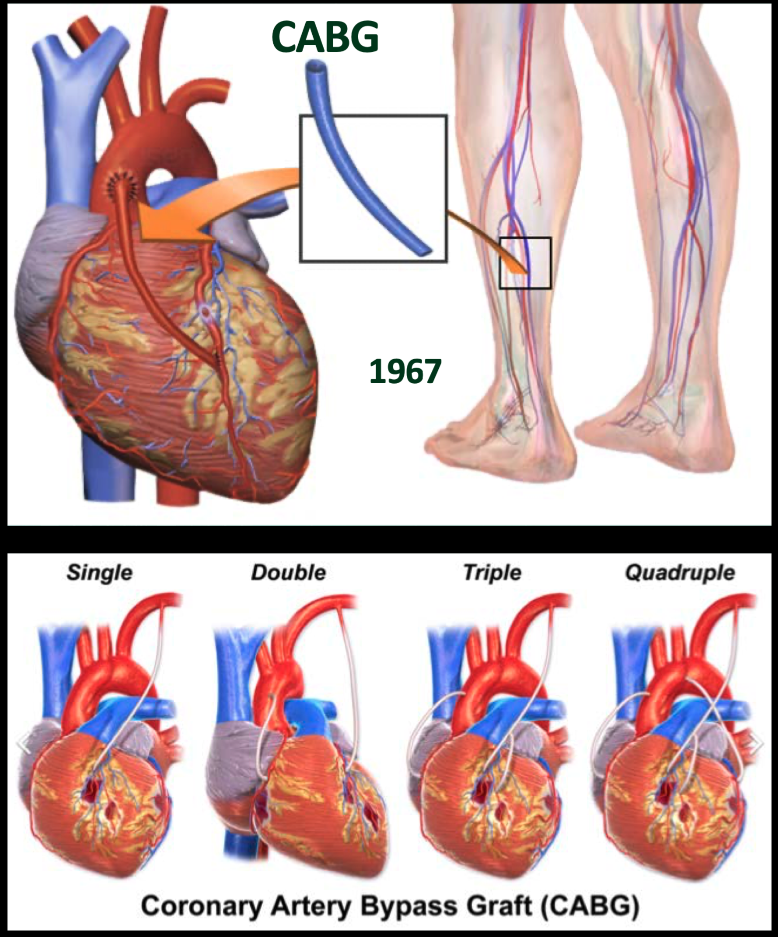        Dr. René Favaloro's pioneering contributions to cardiovascular surgery will be an enduring legacy to his homeland of Argentina and to humanity.    Born on 12 July 1923 in La Plata, capital of the province of Buenos Aires, Dr. Favaloro would de