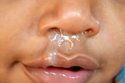 snot-nose-jake.jpg