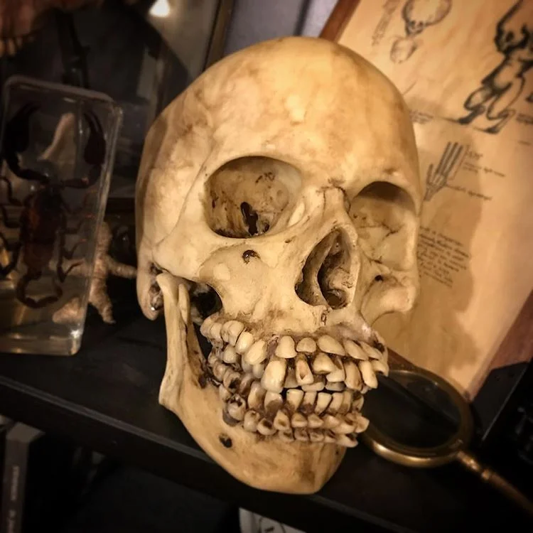hyperdontia.jpg
