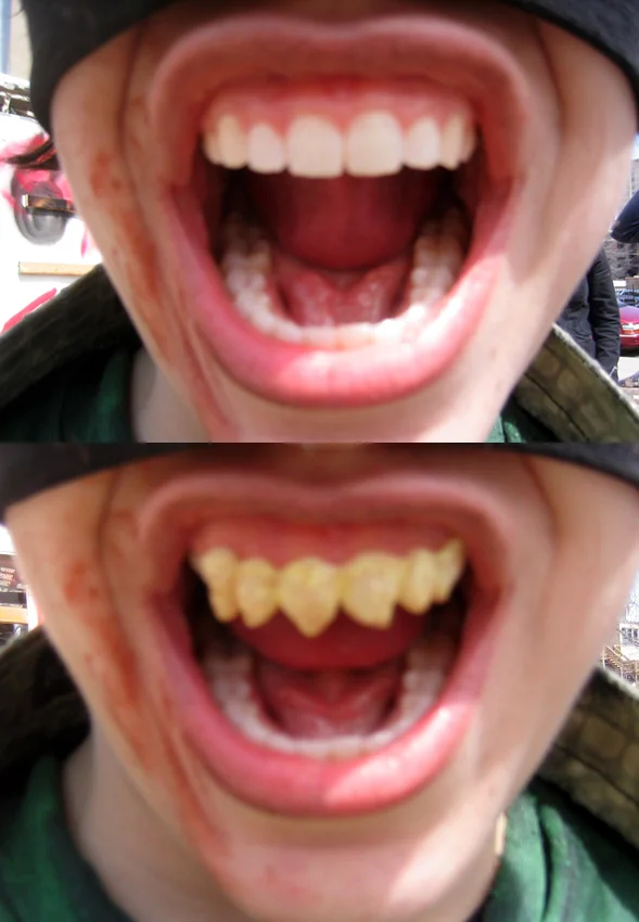 TEEF1.jpg