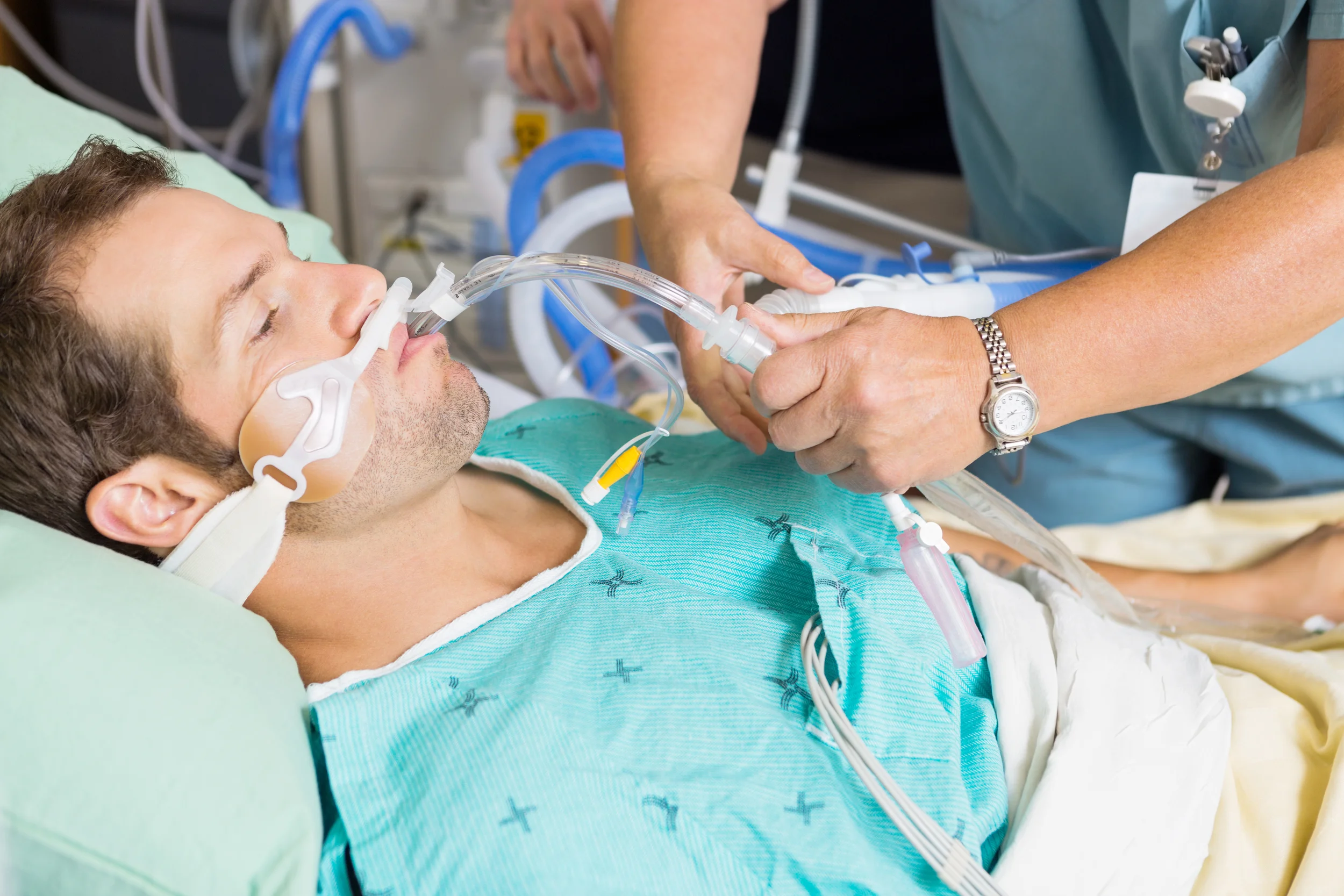 Ventilator: This oxygen delivery system gives patient oxygen in percentages of the air that is oxygen (meaning that the air delivered is 50% oxygen). The ventilator is hooked up to the patient via an endotracheal (ET) tube (meaning a tube in the trachea). Patients are sedated when inserting the ET tube by the provider. Patients are placed on the ventilator for a variety of reasons: they have exhausted their respiratory drive, there is an airway obstruction, when sedation is needed (surgery or intense withdrawals), and many other reasons. There are a variety of other settings that the doctor can play with as well. It can be set up to deliver the patient certain amount of volume per breath or a certain amount of pressure per breath. The ventilator can give mandatory breaths to patients, allow patients to take breaths on their own, or a combination of the two. Learn more about what you as a nurse can do to assist the physician during endotracheal intubation . 