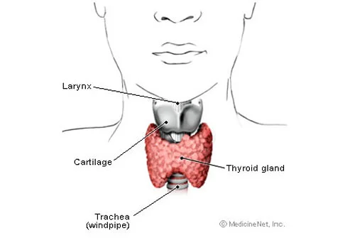 Myxedema Coma From New To Icu