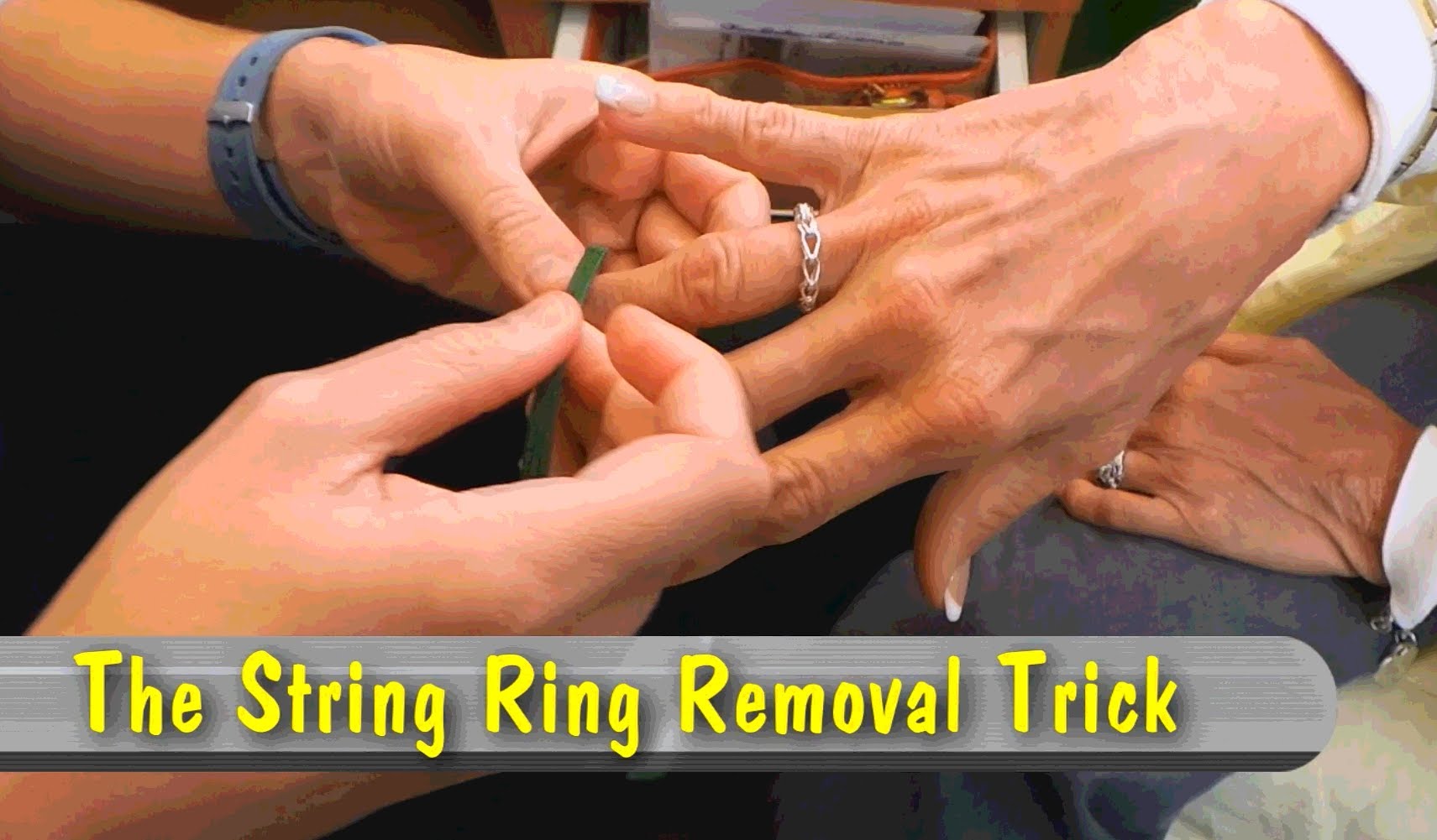 The String Ring Removal Trick — From New to ICU