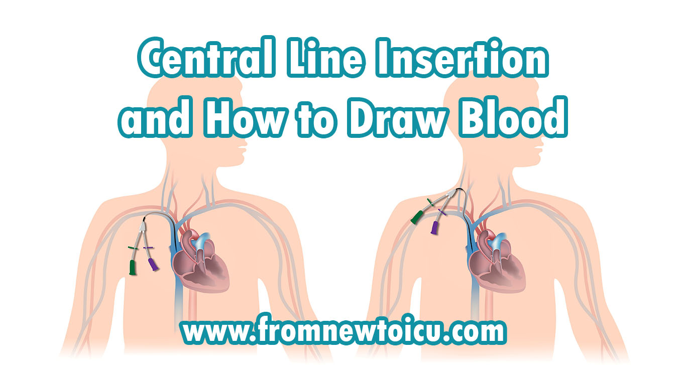 blood culture - bd on drawing blood cultures from a port