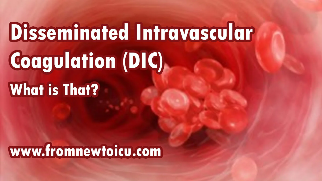 Disseminated Intravascular Coagulation (DIC)...What Is That? — From New