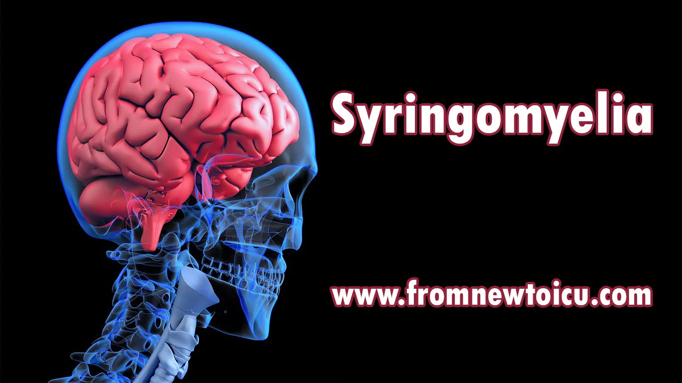 Syringemyelia spinal cyst.jpg