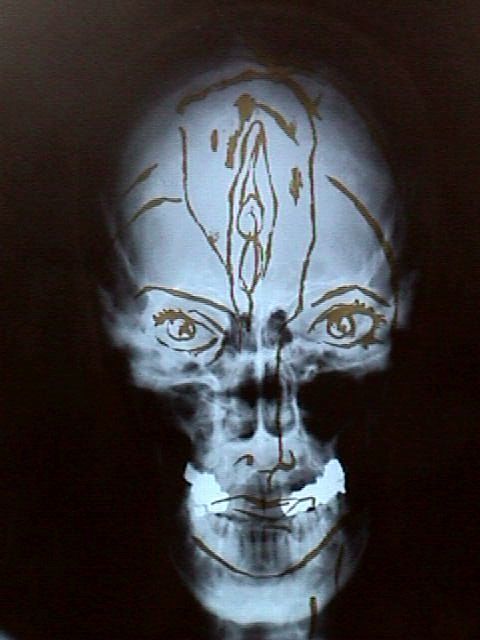 Self portrait, gold paint on X-Ray