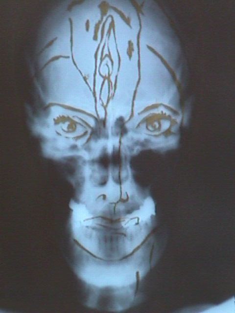 Andree Weschler X ray.jpg