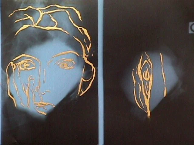 Andree Weschler radiograohie .jpg