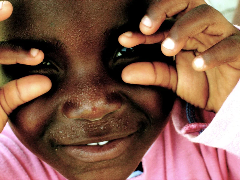 Akwaaba, 2006, Ghana