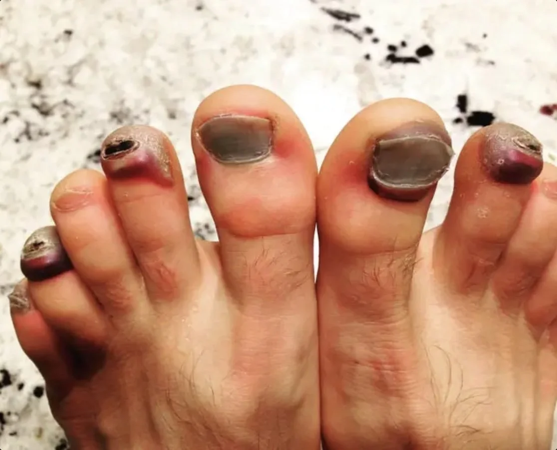 toes.jpg