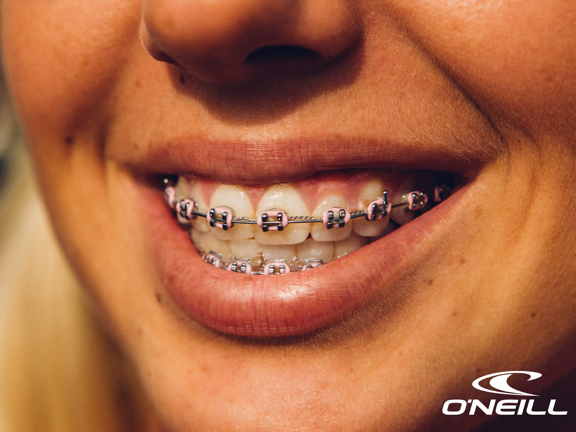 rucker-braces-2018-0010 copy.jpg