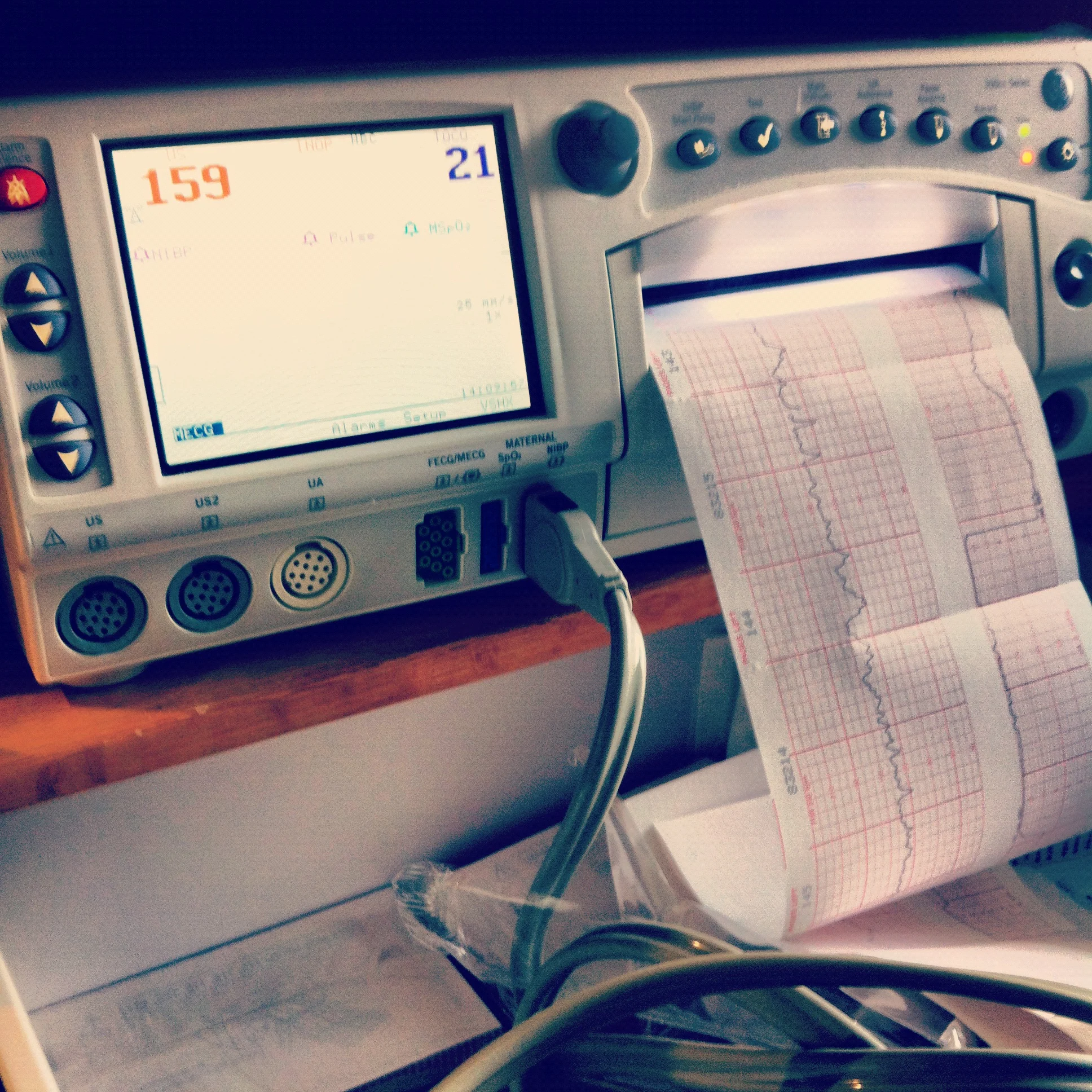 monitor-electronic-fetal.jpg