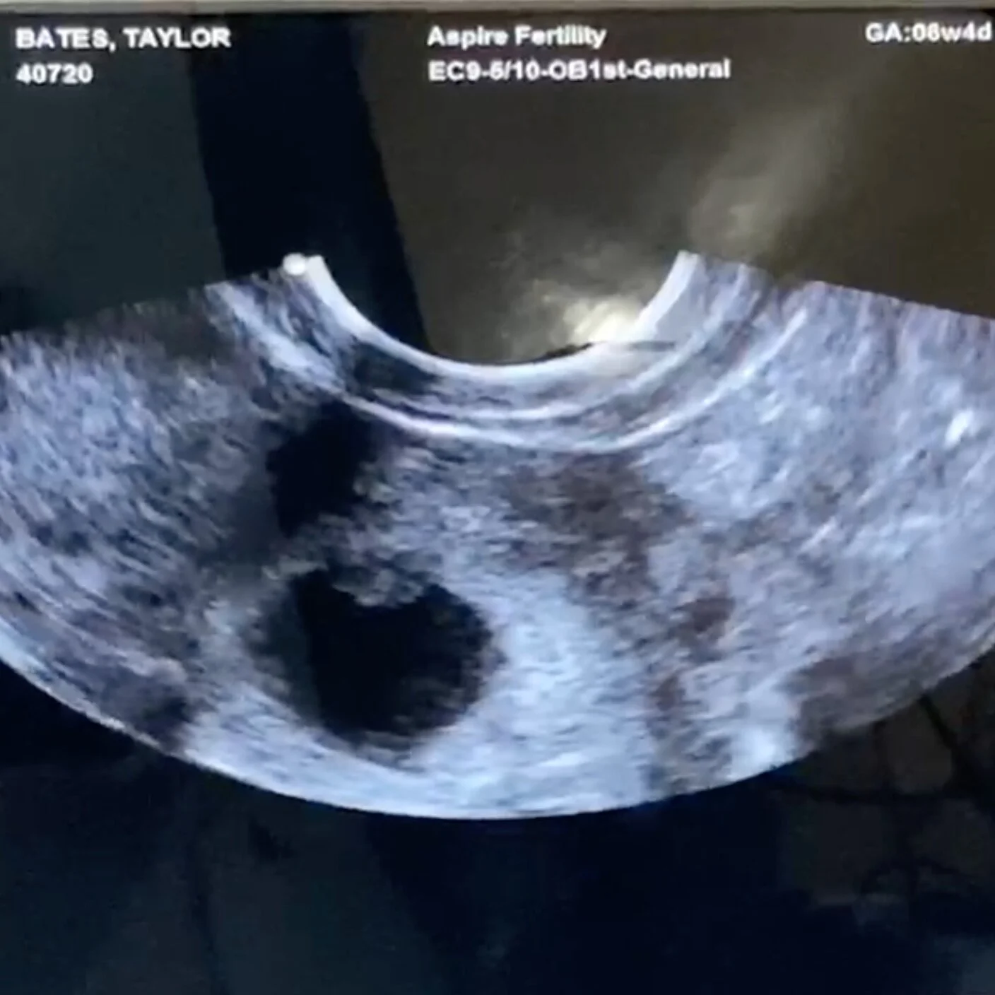 The Biggest Tiniest Miracle