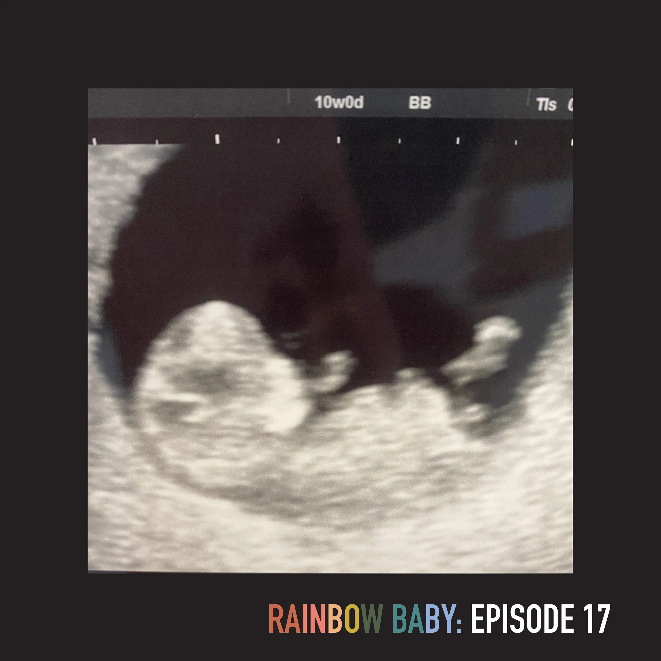 Episode 17: Pregnancy Weeks 10-11, Seeing a Perinatal Specialist