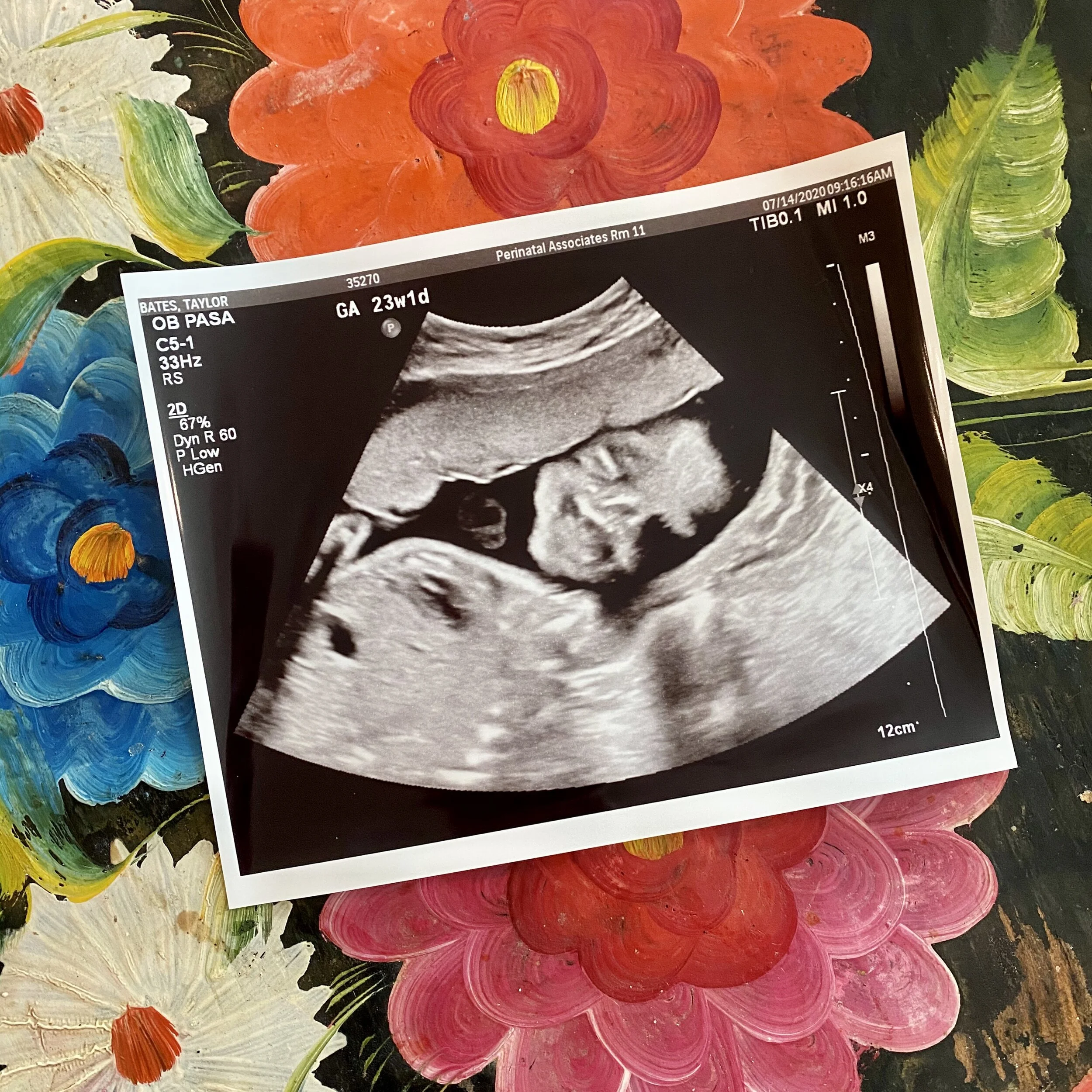 23 Week Pregnancy Scan