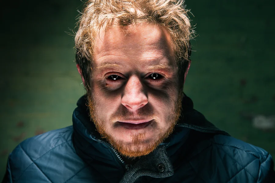 A man with disheveled blond hair, a beard, and dark circles under his eyes, wearing a dark jacket, looking directly at the camera with a serious expression.