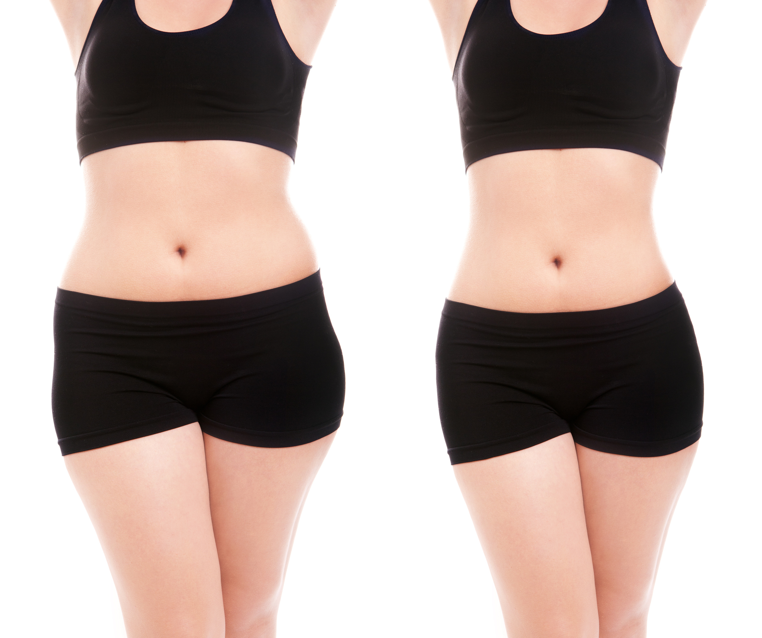When searching stock photos for before and after this is what I found, I happen to think both ladies are lovely. 