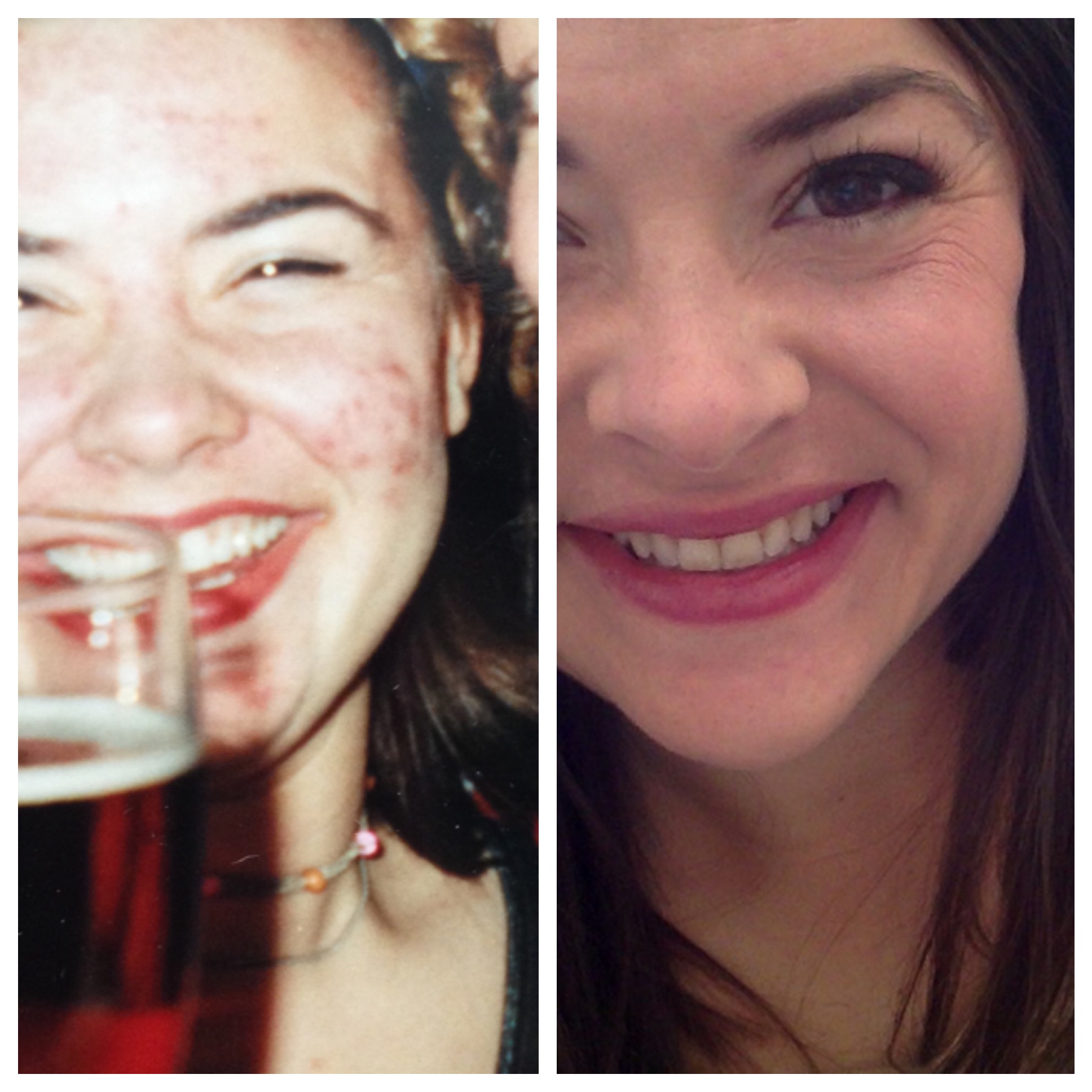 On the left is my 20th birthday, on the right is now (I am 35 but you can just call me 29).