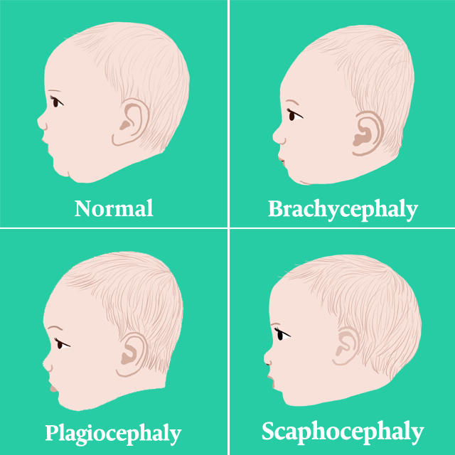The Bump From The Knot Decue Wu The Bump From The Knot Decue Wu
