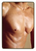  Gynecomastia
