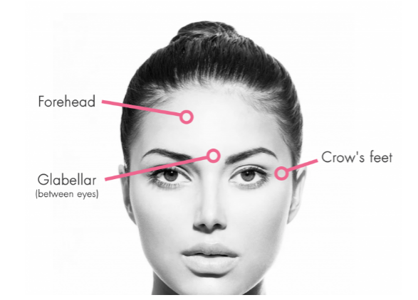 thumbnail_House of Vain sites for botox.png